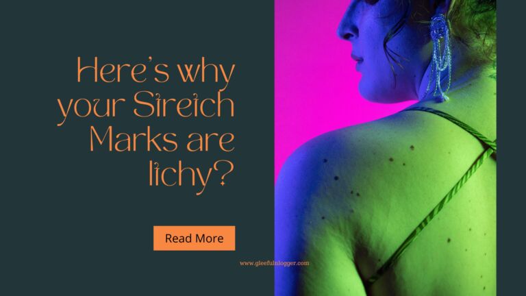itchy stretch marks